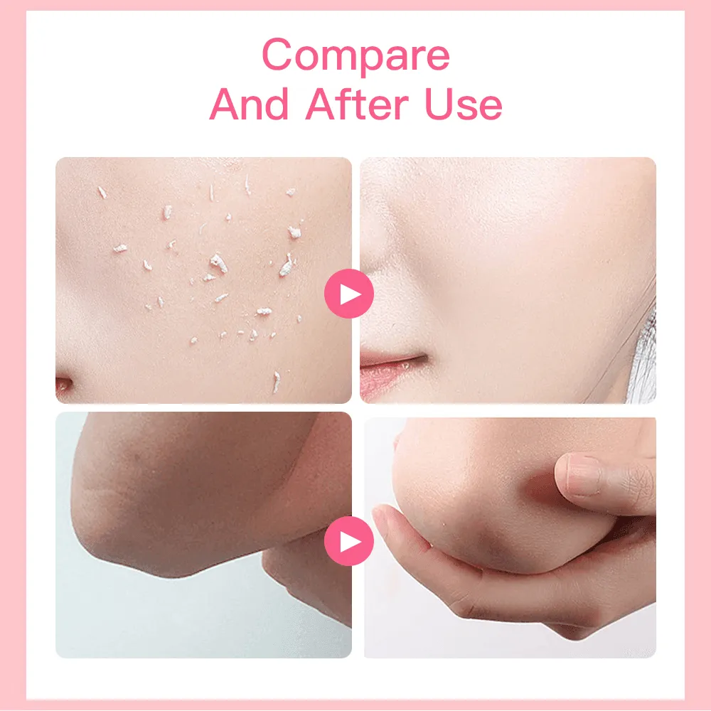 Aichun Beauty Strawberry Whitening Skin Peeling Gel Face & Body - 100g