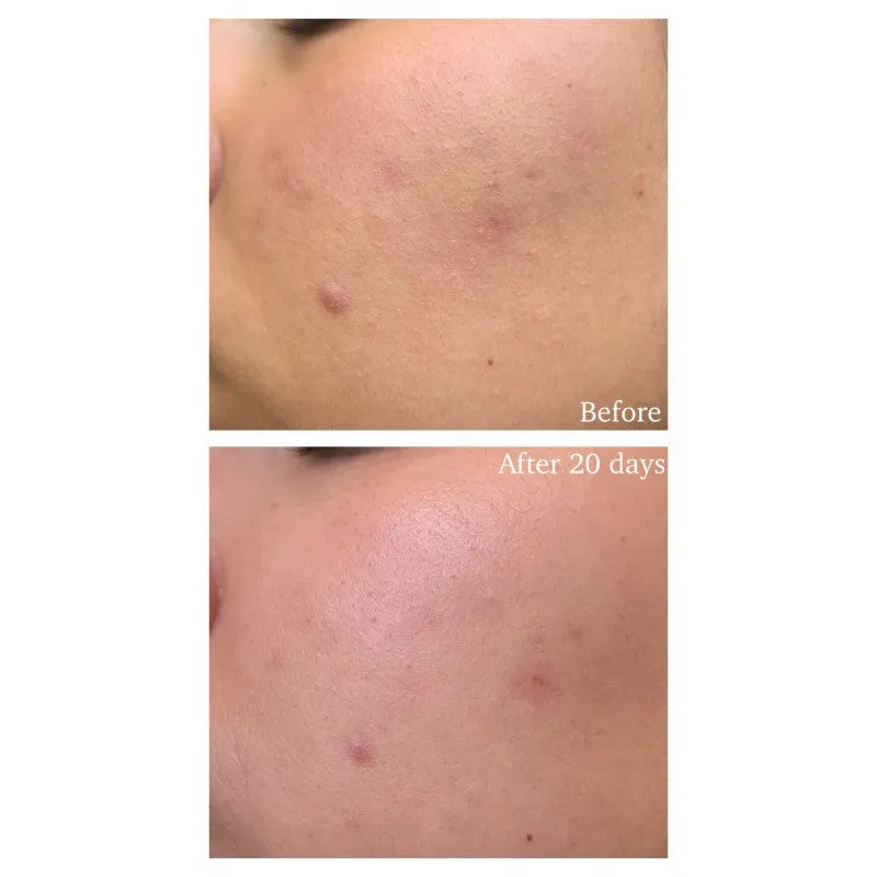 Glow Recipe Watermelon Glow PHA  BHA Pore-Tight Toner