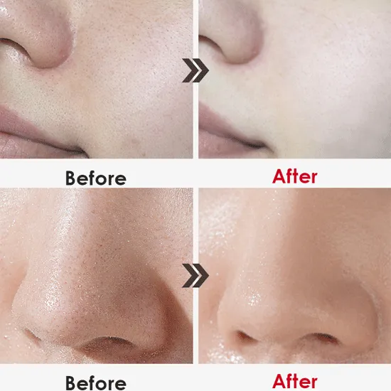 [MEDI-PEEL] Red Lacto Collagen Clear 300ml